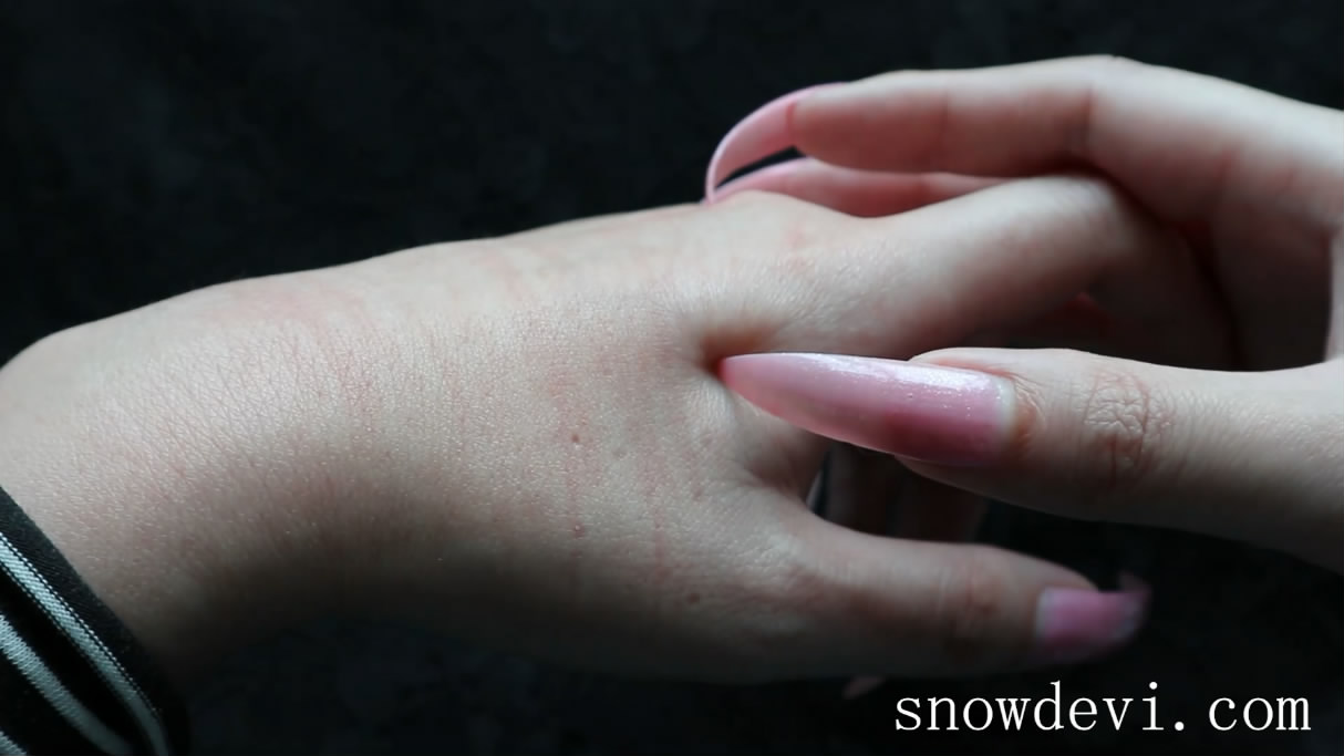 SNOW1109-Scratching Hand